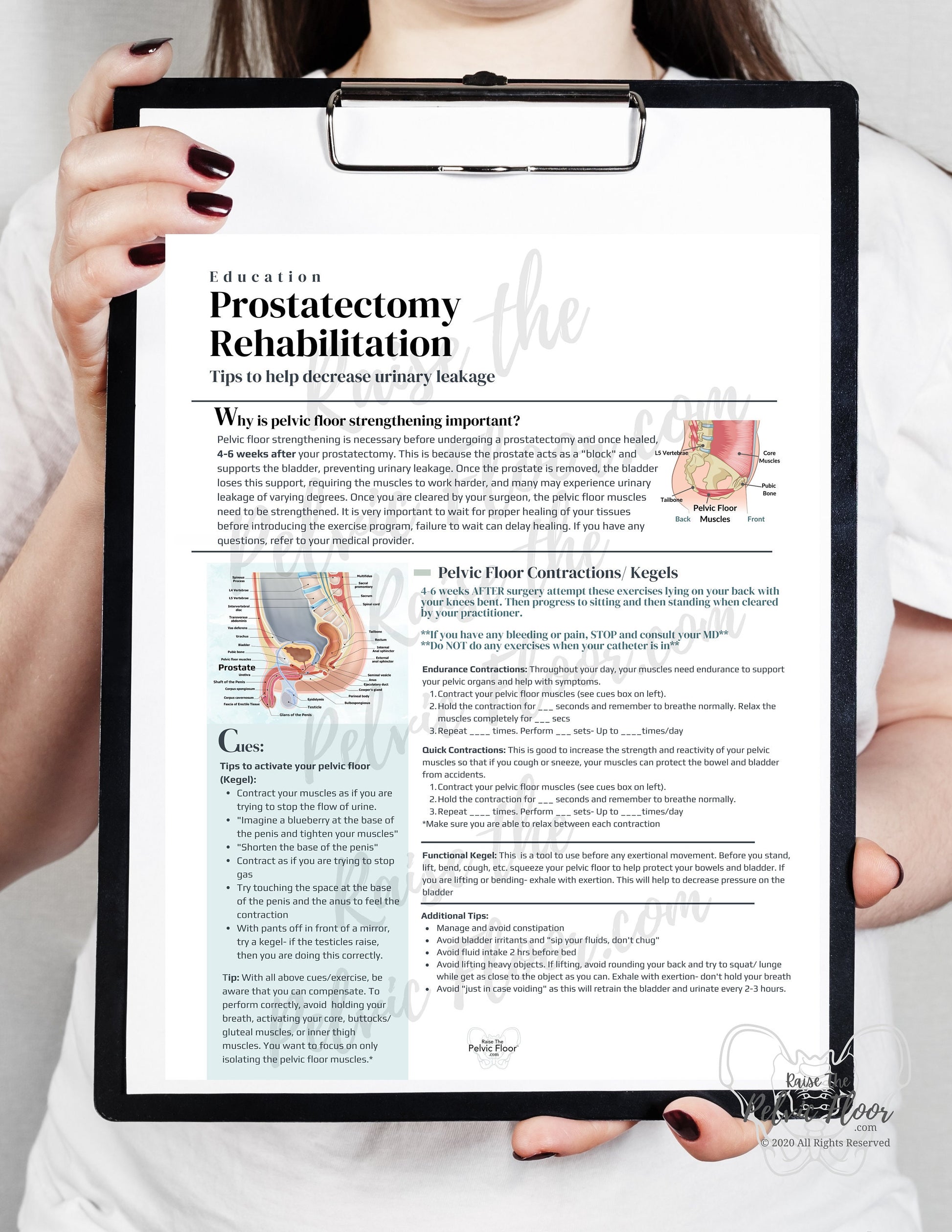 Prostatectomy Rehabilitation *Digital Download* Patient Education Handout- Pelvic Health, Prostate, Prostatectomy, Penis, Urine Leakage